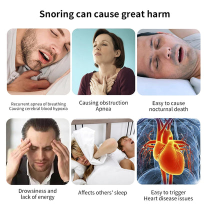 SilentSleep - Smart Anti-snoring Device