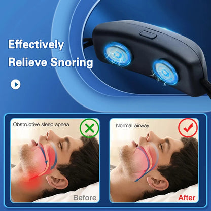 SilentNight Pulse - Anti-Snore EMS Therapy