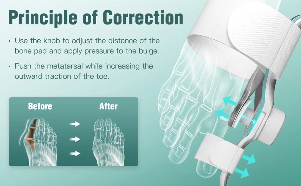 FootFlex Pro - Orthopedic Bunion & Hammer Toe Correction