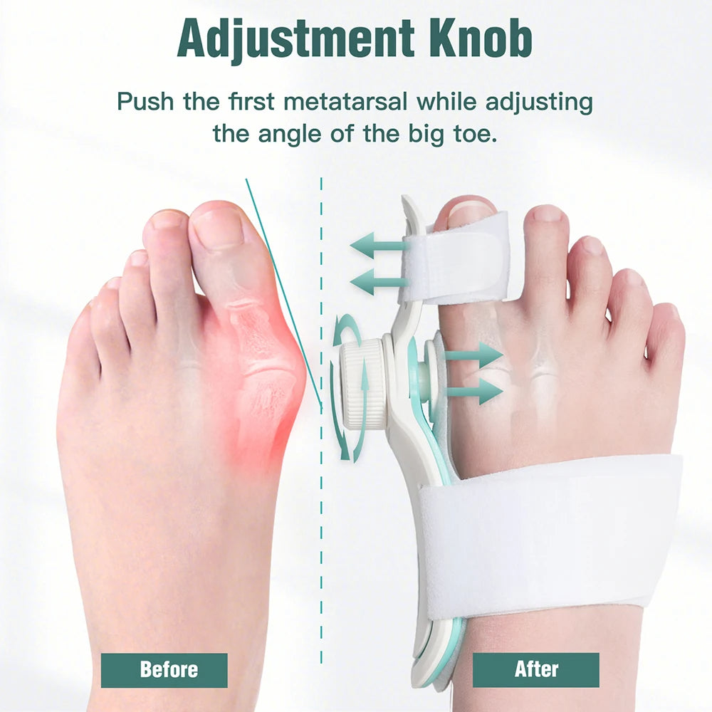 FootFlex Pro - Orthopedic Bunion & Hammer Toe Correction