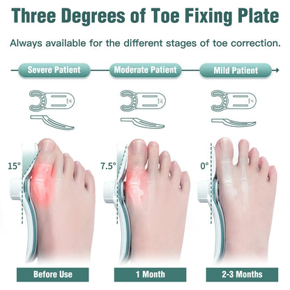 FootFlex Pro - Orthopedic Bunion & Hammer Toe Correction